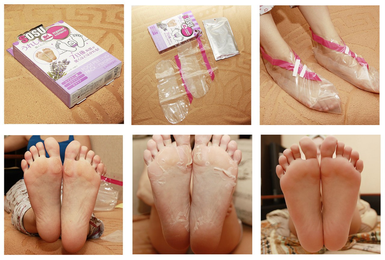 Комфортное применение педикюрных носков
